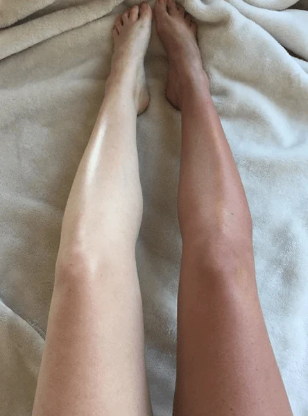 Piernas antes y después del bronceado, en la misma foto